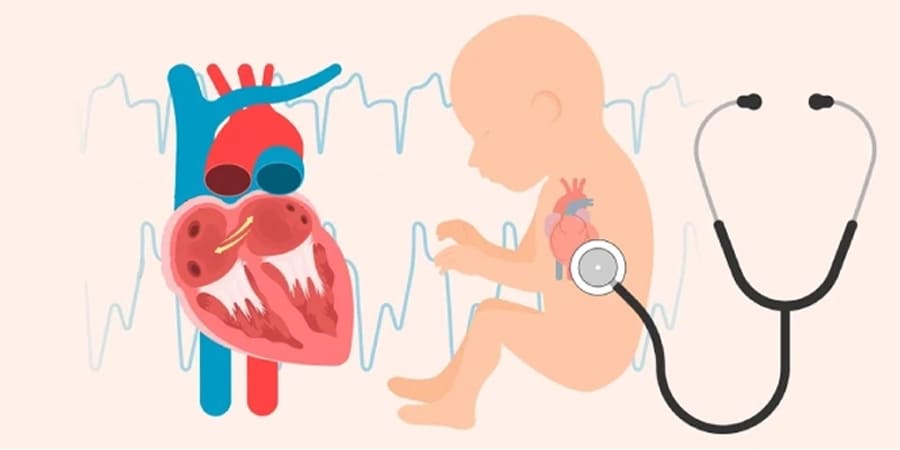 paediatric-heart-surgery