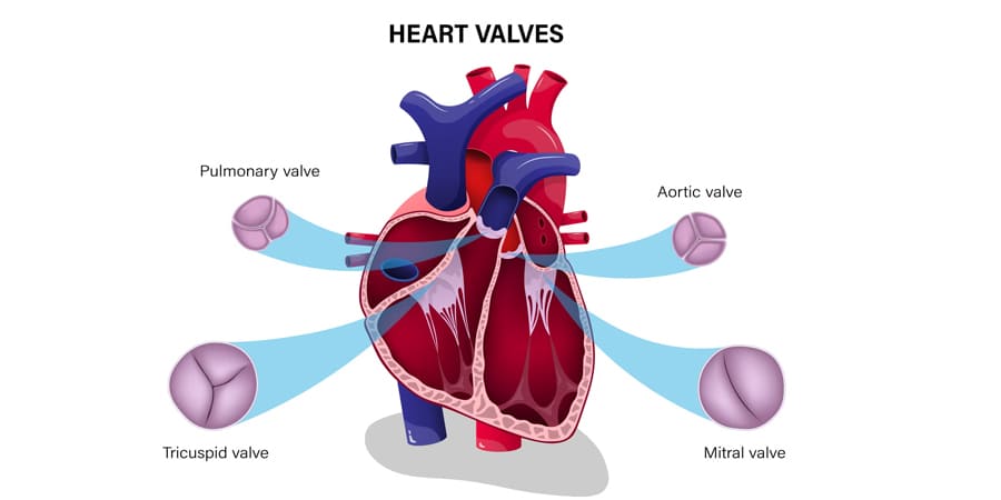valvular-heart-disease