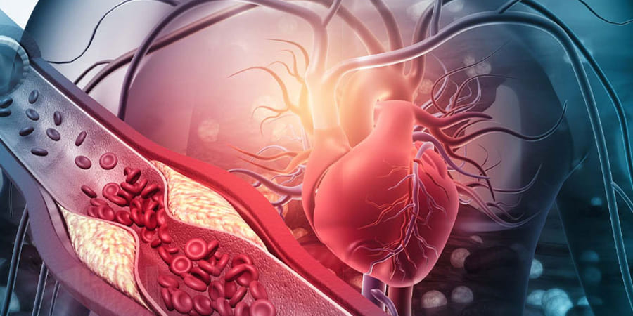 vascular-surgery